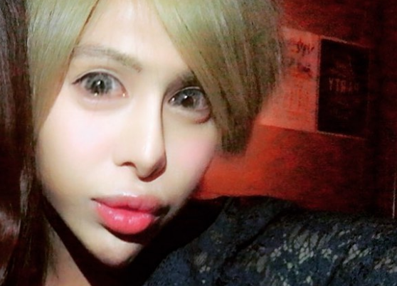 インスタ 整形 男子 アレン